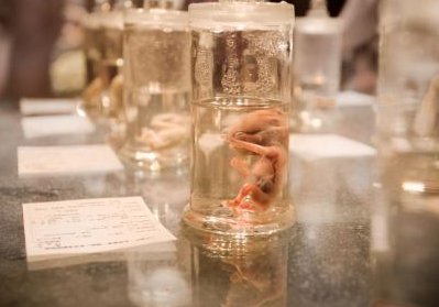 2026苏州市医院试管婴儿费用大约多少？内附费用明细清单！