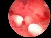 钦州做试管婴儿成功率如何？先来看看哪些医院提供试管服务