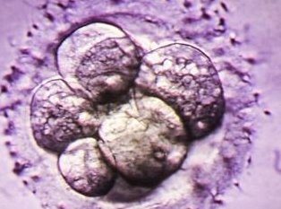 做了结扎手术可以在长葛市试管医院做试管婴儿吗？费用是多少